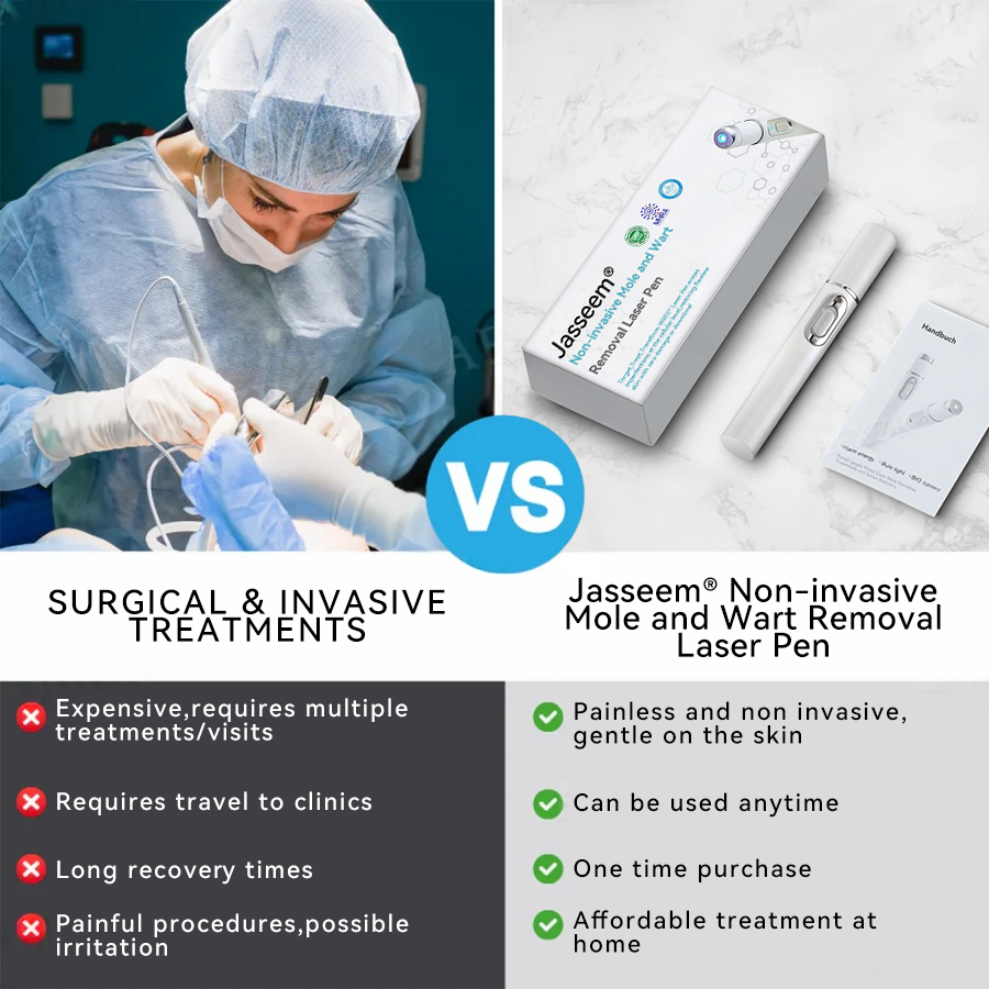 𝐉𝐚𝐬𝐬𝐞𝐞𝐦® 💛𝐍𝐨𝐧-𝐢𝐧𝐯𝐚𝐬𝐢𝐯𝐞 𝐌𝐨𝐥𝐞 𝐚𝐧𝐝 𝐖𝐚𝐫𝐭 𝐑𝐞𝐦𝐨𝐯𝐚𝐥 𝐋𝐚𝐬𝐞𝐫 𝐏𝐞𝐧 (Quick and painless removal of warts, moles, age spots and skin tags - without any side effects)